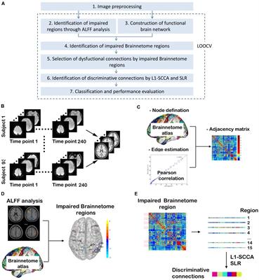 Less Is Better: Single-Digit Brain Functional Connections Predict T2DM and T2DM-Induced Cognitive Impairment